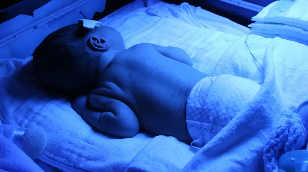 Fototerapia en prematuros: tratamiento y recomendaciones 2 fototerapia neonatos