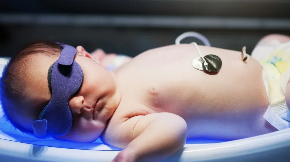 Fototerapia en prematuros: tratamiento y recomendaciones 3 Diseno sin titulo 27